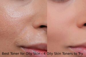 Best Toner for Oily Skin - 4 Oily Skin Toners to Try