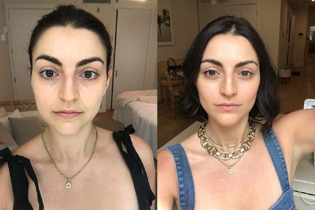 retinol before and after